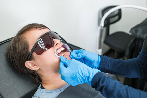 Best Knocked-Out Tooth (Avulsed Tooth) Treatment in Iowa Falls, IA